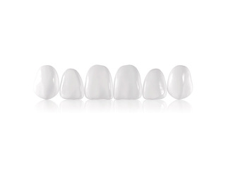 Componeer Set виниры верхний ряд 11/12/13/21/22/23, размер L, цвет White Opalescent, 6 шт. COLTENE 1313