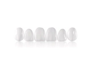 Componeer Set виниры верхний ряд 11/12/13/21/22/23, размер M, цвет White Opalescent, 6 шт. COLTENE 1312